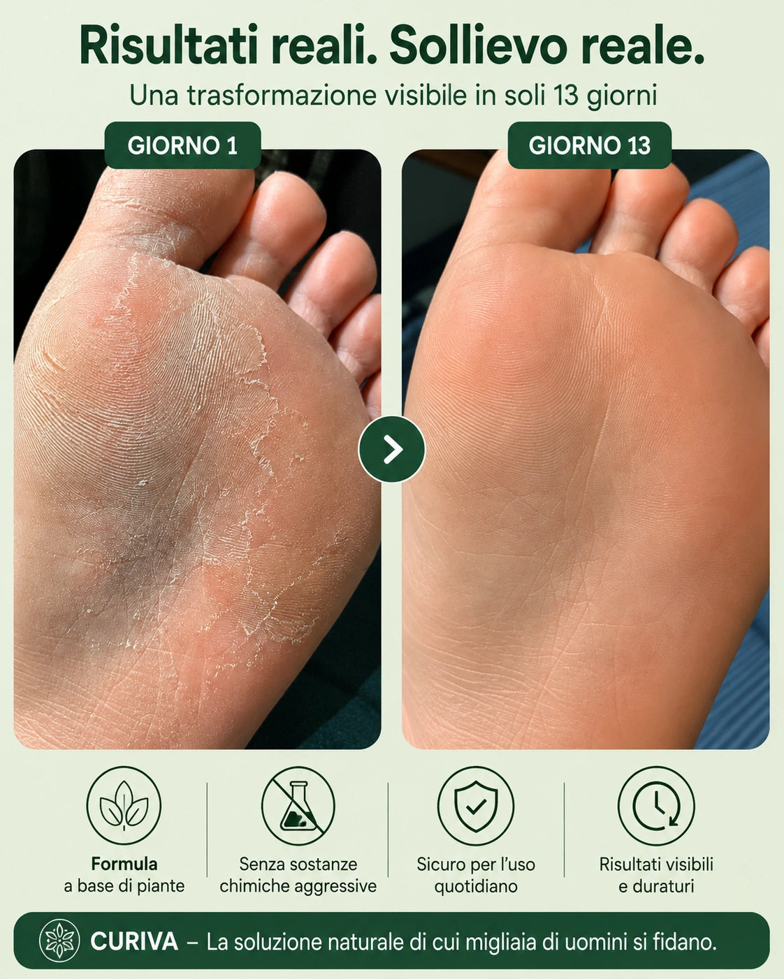 Sapone antimicotico CURIVA®