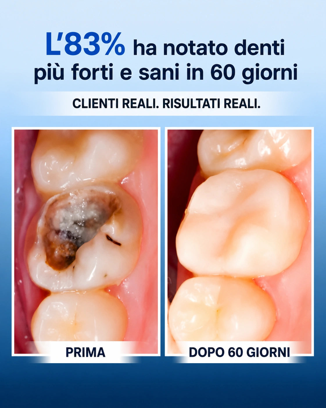 Curiva Scudo Dentale