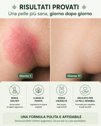 Sapone antimicotico CURIVA®